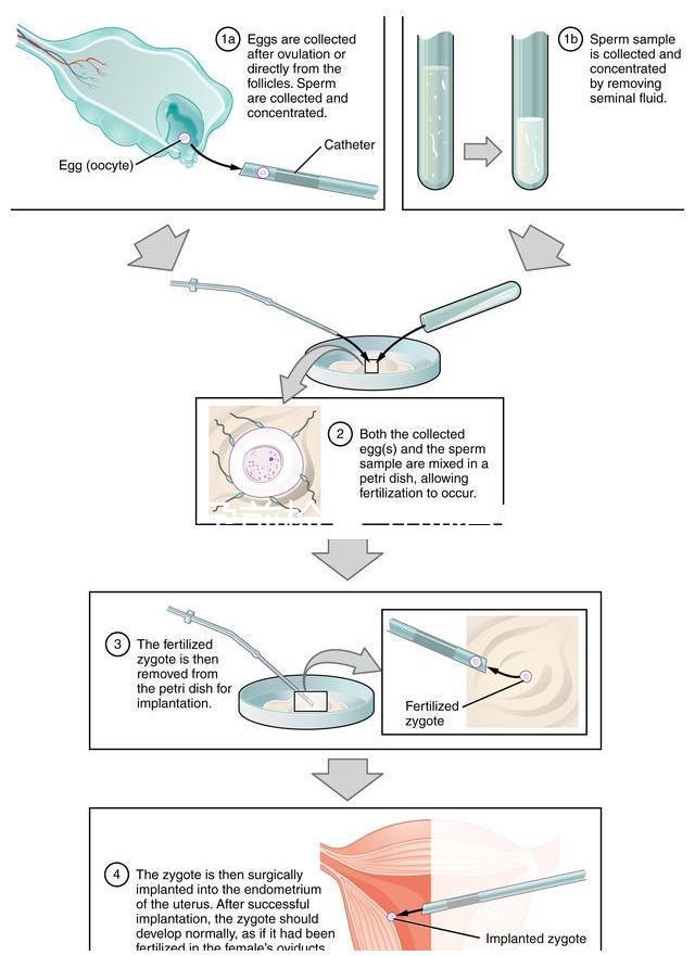 男性孕前檢查事項有哪些