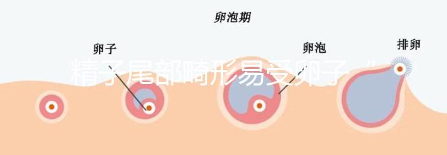 精子尾部畸形易受卵子“嫌棄”，無尾、短卷尾需重視