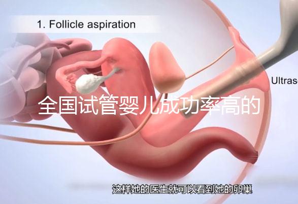 全國試管嬰兒成功率高的醫院排名,內附2023試管費用及成功率參考