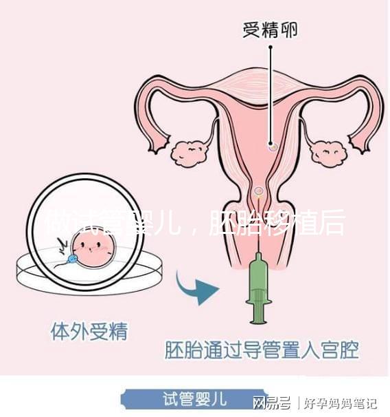 做試管嬰兒，胚胎移植后需要住院嗎？