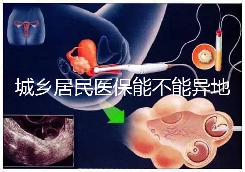 城鄉(xiāng)居民醫(yī)保能不能異地試管報銷？詳解2025試管醫(yī)保異地報銷的流程