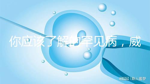 你應該了解的罕見病，威廉姆斯綜合癥