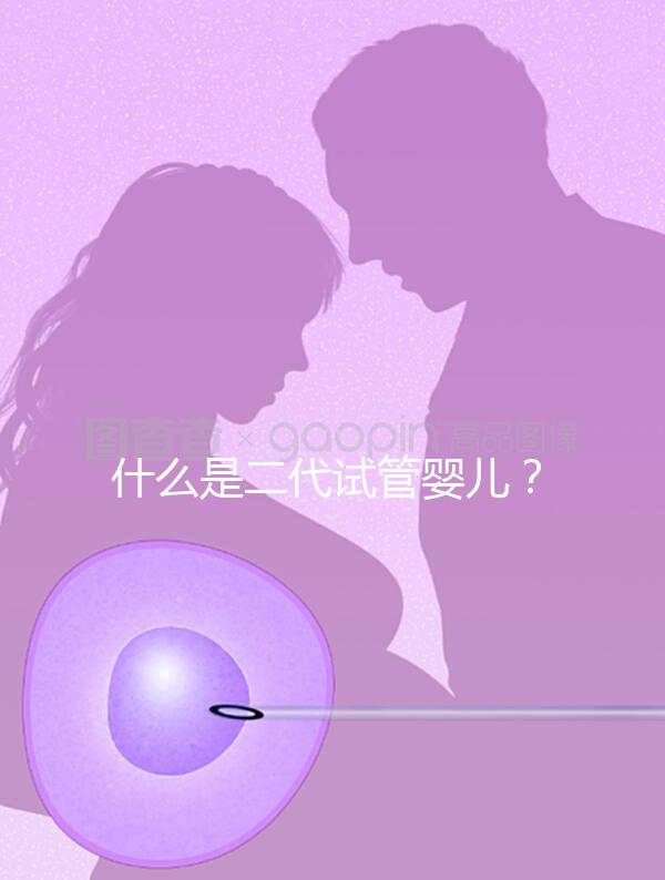 什么是二代試管嬰兒？