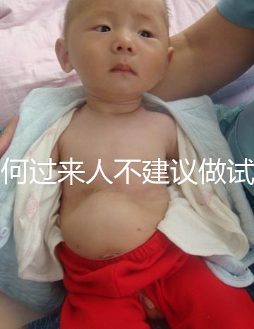 為何過(guò)來(lái)人不建議做試管嬰兒