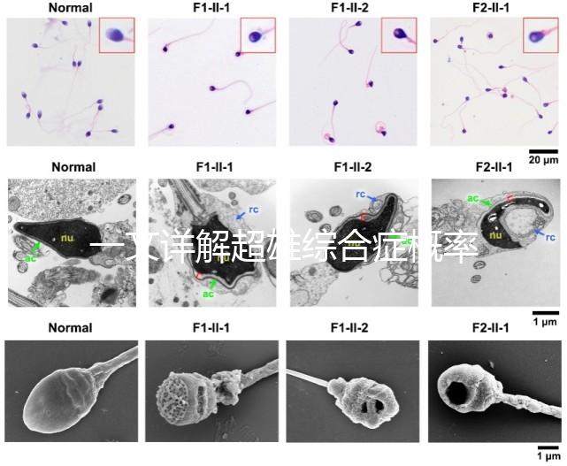 一文詳解超雄綜合癥概率有多大,想造的人多不多看過來