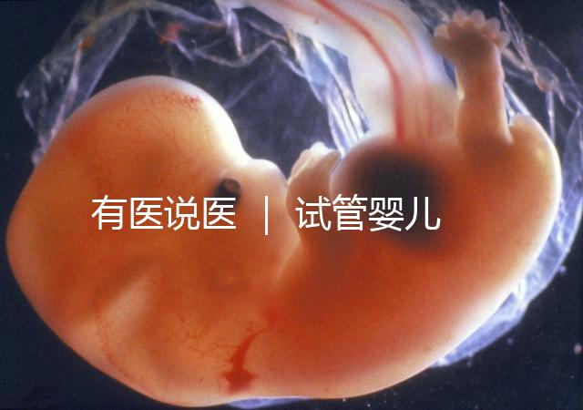 有醫說醫 ｜ 試管嬰兒技術不能避免宮外孕，“三孩”時代警惕宮外孕發生率增加