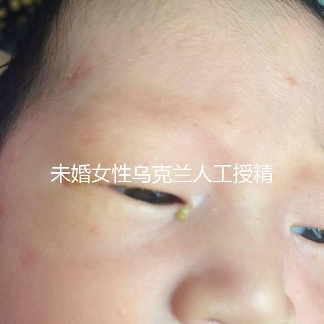 未婚女性烏克蘭人工授精必看！醫療及生活費用明細預覽