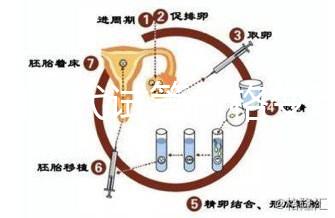 泰國三代試管價格變動，2025年最新費用行情一覽