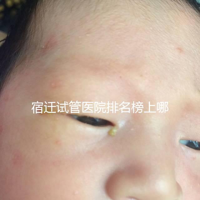 宿遷試管醫院排名榜上哪家好，不造助孕成功率和費用別亂選