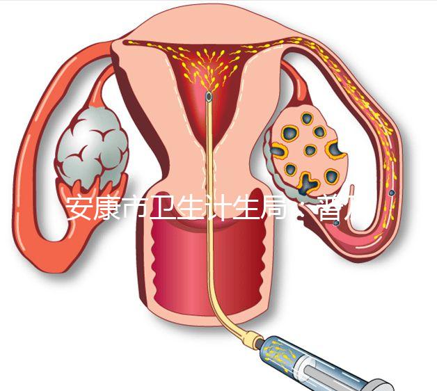 安康市衛生計生局：普及優生優育五項檢查相關知識