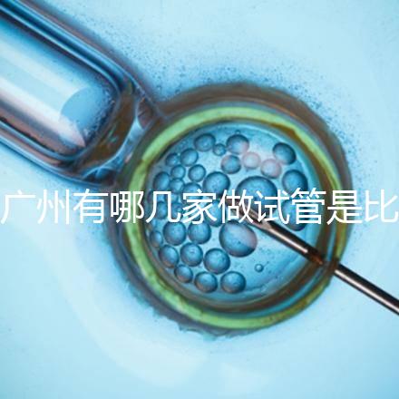 廣州有哪幾家做試管是比較靠譜的，最近有打算？