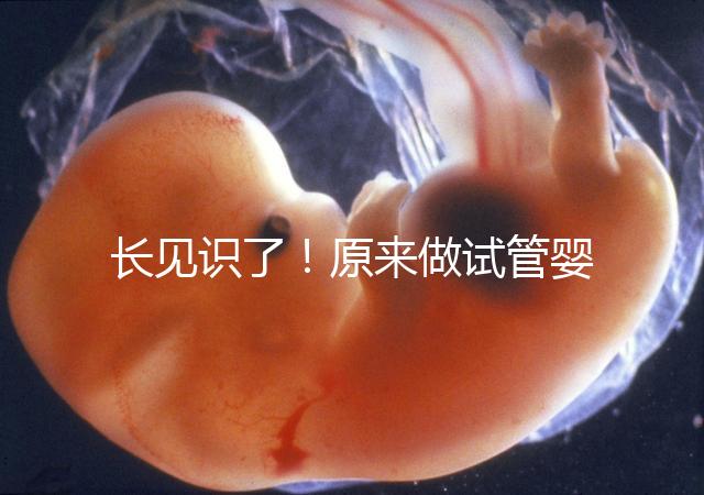 長見識了!原來做試管嬰兒,精子是這樣被篩選出來的