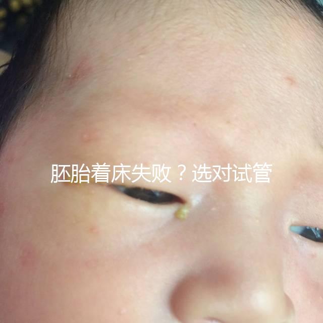 胚胎著床失敗？選對試管嬰兒醫生很重要