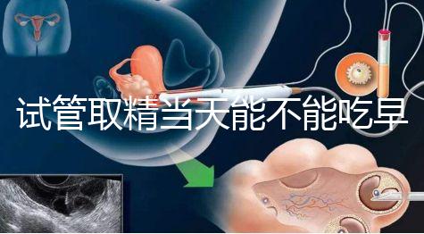 試管取精當(dāng)天能不能吃早餐喝水的答案來咯咯，好不好一看就知道了？