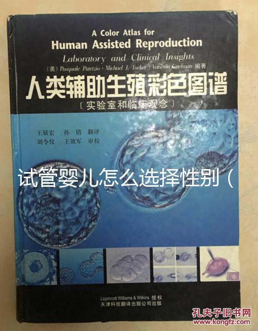 試管嬰兒怎么選擇性別(試管嬰兒怎么選擇性別的)
