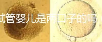 試管嬰兒是兩口子的嗎(試管嬰兒是兩夫妻的孩子嗎)