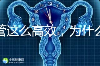 試管這么高效，為什么醫生還推薦人工授精？