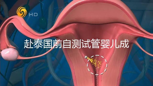 赴泰國前自測試管嬰兒成功率，這些方法值得收藏