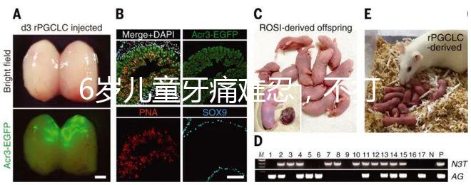 6歲兒童牙痛難忍，不打針吃藥5個小妙招快速止疼