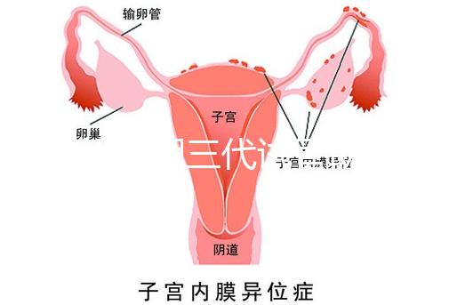 2025昆明三代試管助孕機(jī)構(gòu)收費(fèi)明細(xì),價(jià)格8萬(wàn)至15萬(wàn)不等