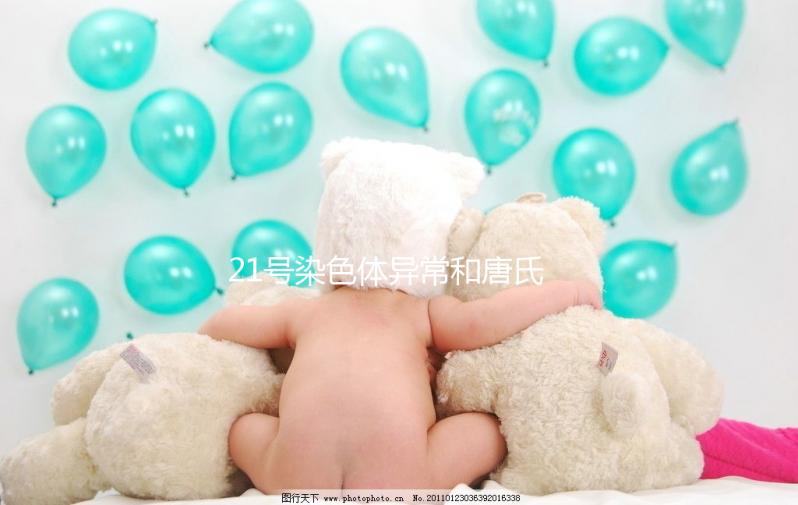 21號染色體異常和唐氏綜合癥關(guān)系不小，你肯定知道